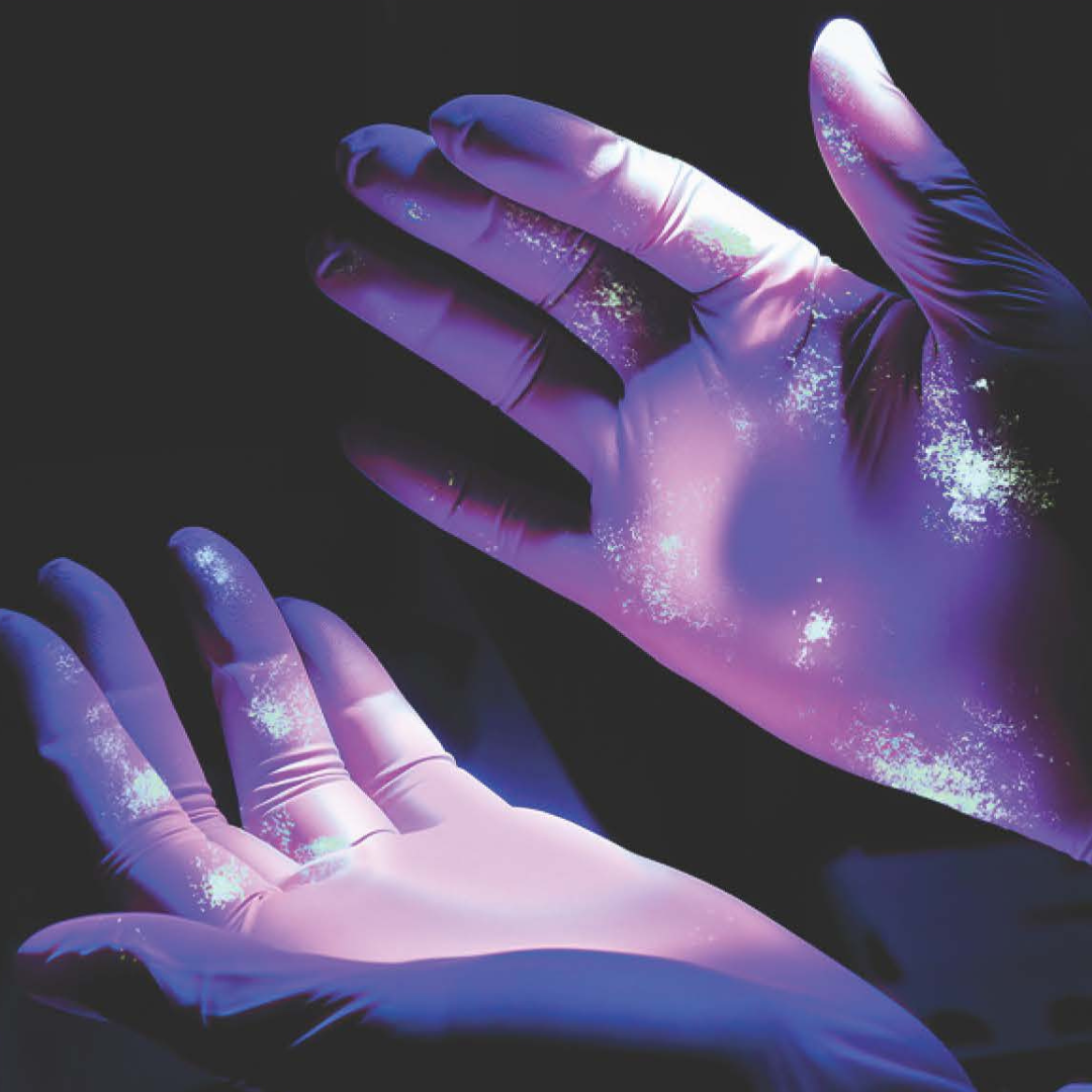 Contaminated gloves